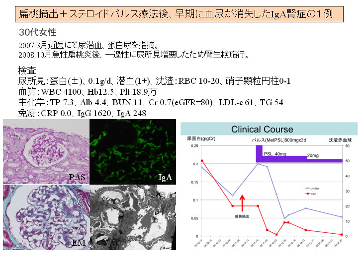 福岡大学 腎臓・膠原病内科