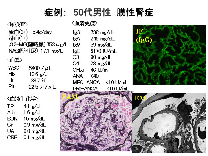 福岡大学 腎臓・膠原病内科